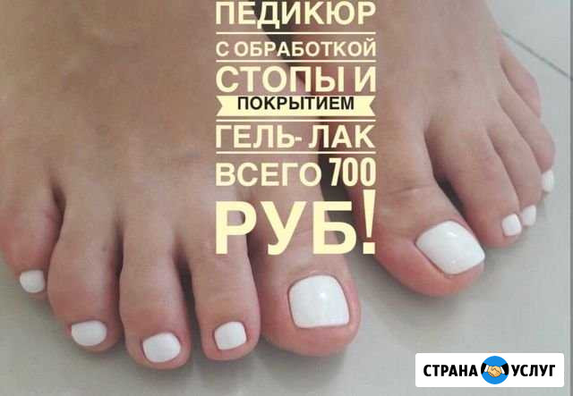 Педикюр Вологда - изображение 1