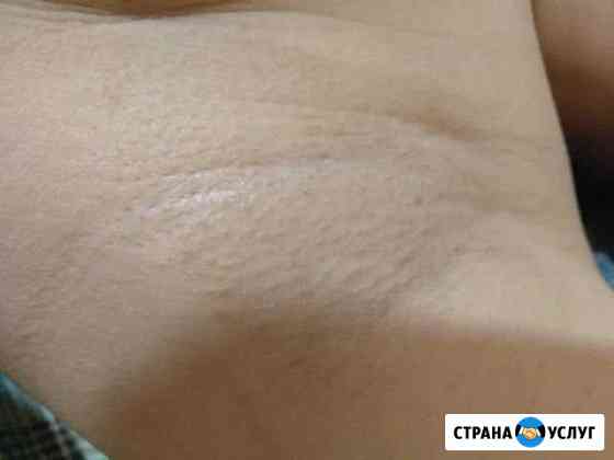 Эпиляция воском Октябрьский