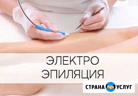 Электроэпиляция Киров - изображение 1