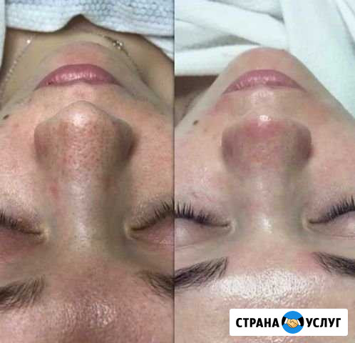 Массаж лица на дому.Косметолог Пушкино - изображение 1