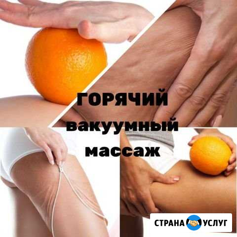 Коррекция фигуры, RF-лифтинг лица и тела Прокопьевск - изображение 1