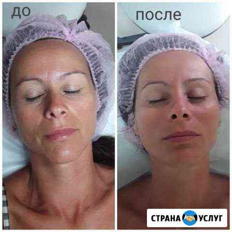 Косметолог. Массаж лица в Анапе Анапа
