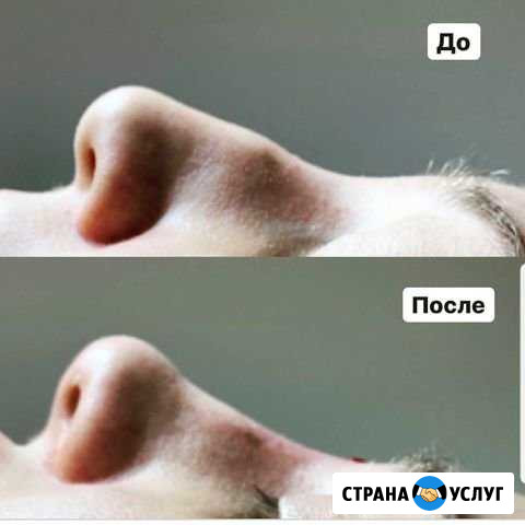 Косметолог Махачкала - изображение 1