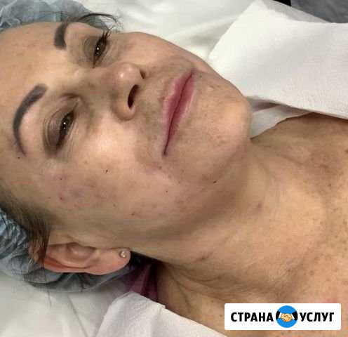 Косметолог Реутов - изображение 1