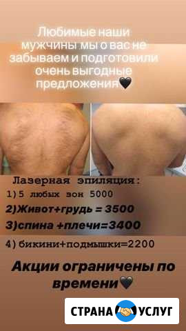 Лазерная эпиляция Электроэпиляция Шугаринг Владикавказ - изображение 1