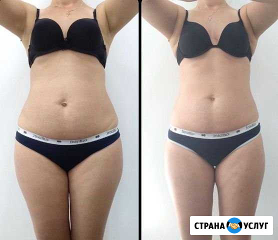Антицеллюлитный массаж Красноярск - изображение 1