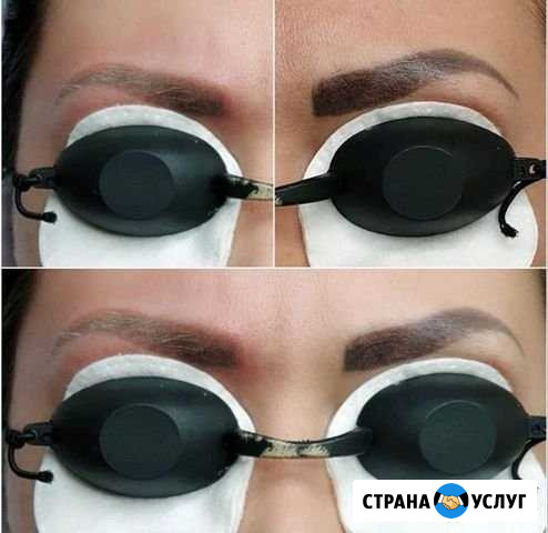Удаление татуировок, татуажа лазером Краснодар - изображение 1