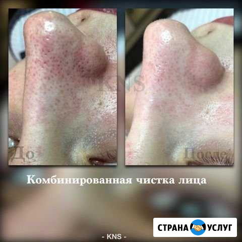 Врач дерматолог,косметолог Санкт-Петербург - изображение 1