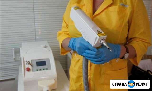 Удаление татуажа/тату Москва - изображение 1