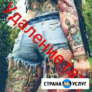Удаление тату и татуажа Новокузнецк - изображение 1