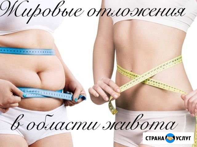 Массаж антицеллюлитный Волгоград - изображение 1