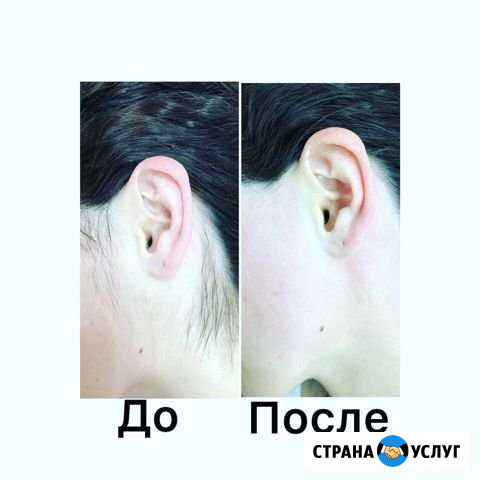 Депиляция Сибай - изображение 1