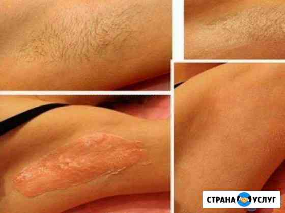 Мужской и женский шугаринг, Центр Челябинск