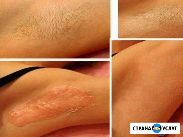 Мужской и женский шугаринг, Центр Челябинск - изображение 1