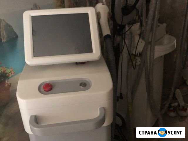 Мужская эпиляция Химки - изображение 1