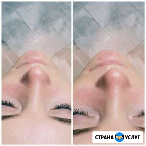 Чистка лица ст.м Нарвская Санкт-Петербург - изображение 1