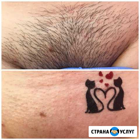 Шугаринг Оренбург - изображение 1