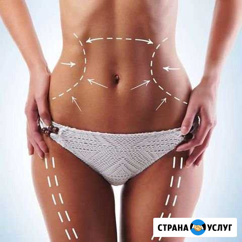 Массаж Антицеллюлитный Братск - изображение 1