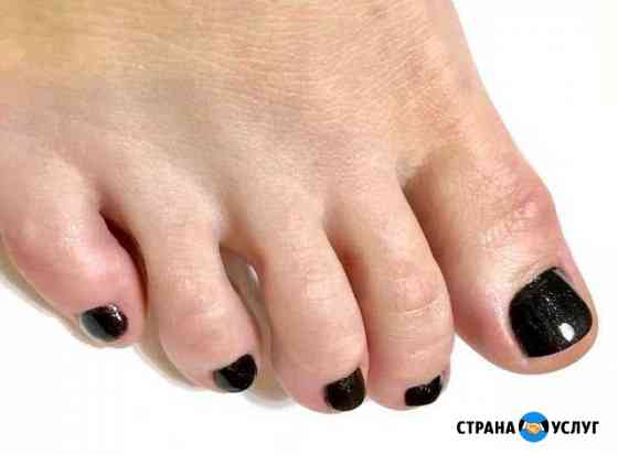 Педикюр Великий Новгород