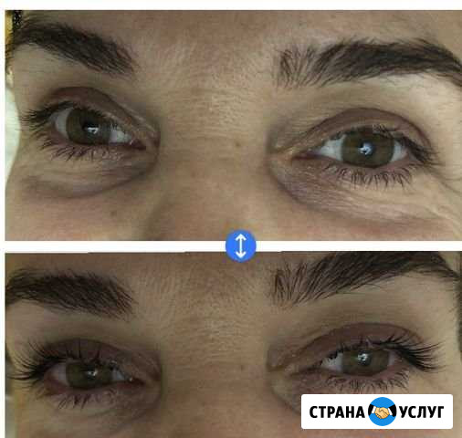 Эстет косметолог Махачкала - изображение 1