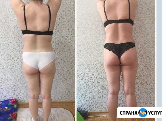 Аппаратный и ручной массаж Астрахань - изображение 1