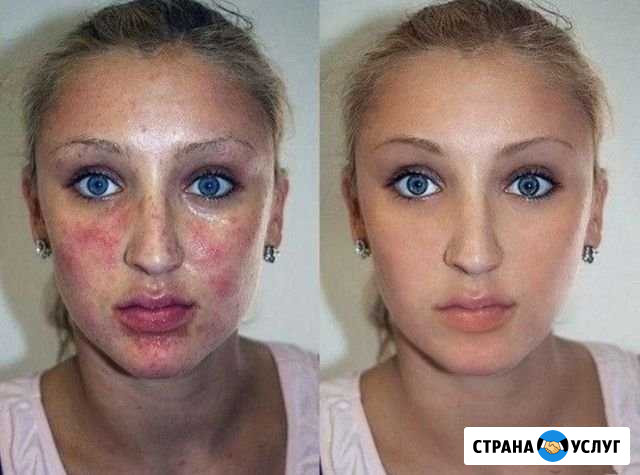 Обработка Фотографий / Фотошоп / Ретушь Пятигорск - изображение 1