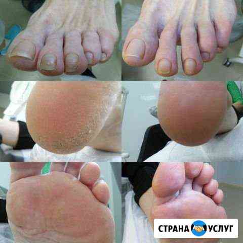 Педикюр гигиенический Магнитогорск