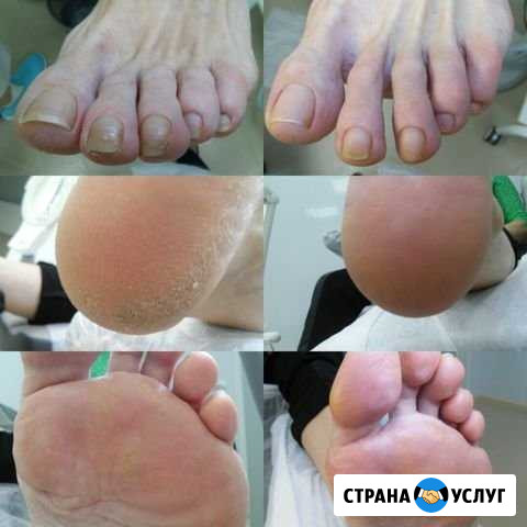 Педикюр гигиенический Магнитогорск - изображение 1