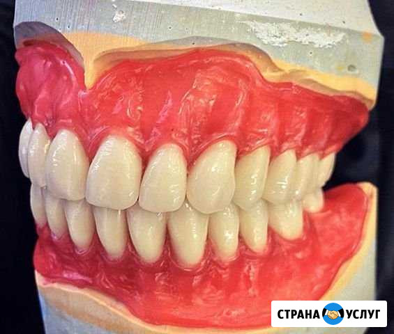 Съёмные зубные протезы Махачкала - изображение 1