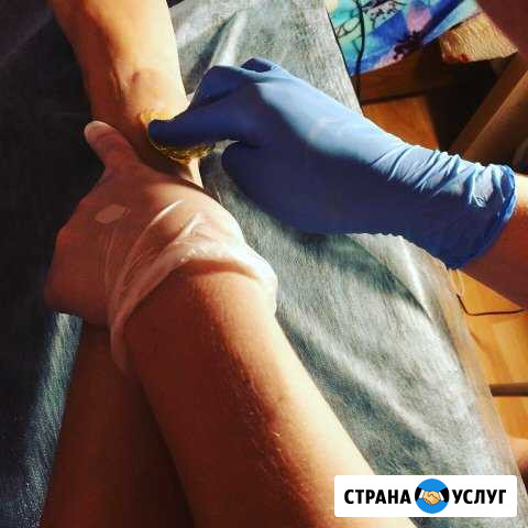 Шугаринг Саратов - изображение 1