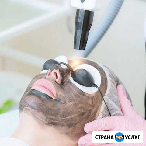 Карбоновый пилинг Краснодар - изображение 1