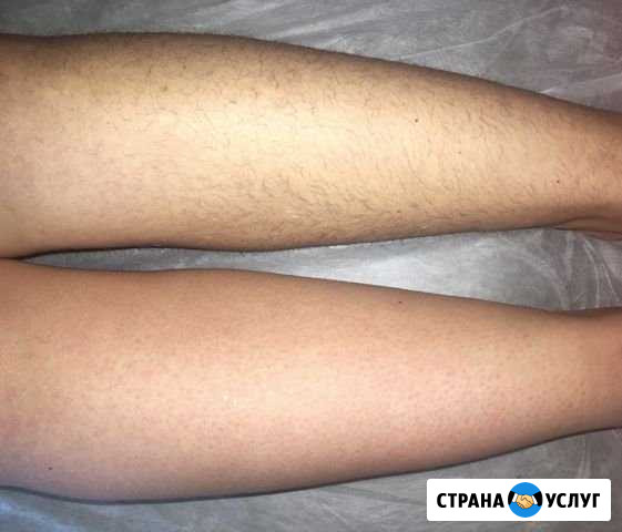 Шугаринг Санкт-Петербург - изображение 1