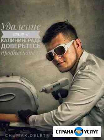 Удаление тату Калининград