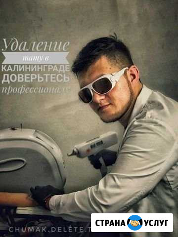 Удаление тату Калининград - изображение 1