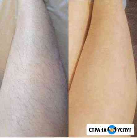 Депиляция Новосибирск