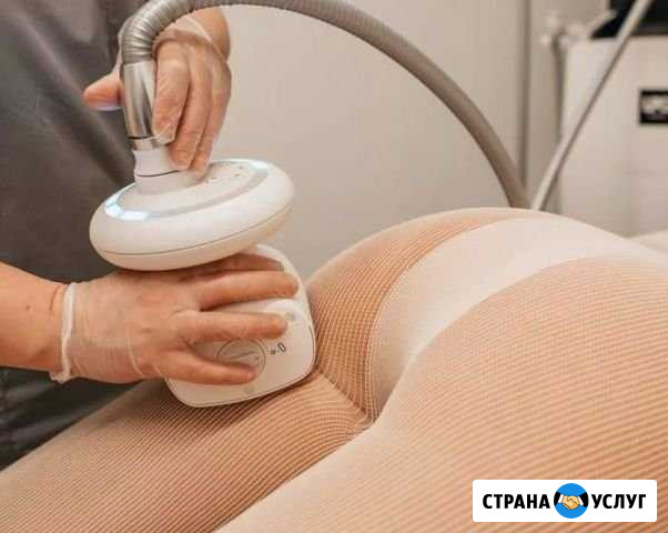 LPG массаж Рязань - изображение 1