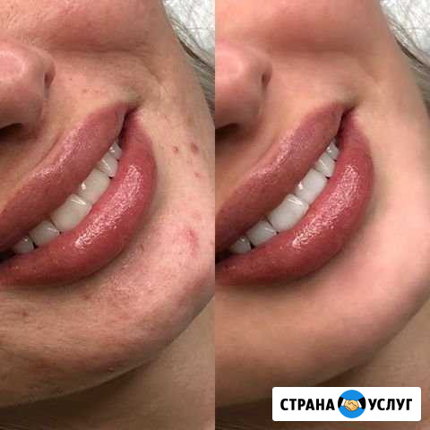 Ретушь фотографий Новосибирск - изображение 1