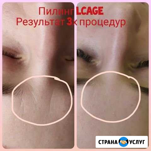 Массаж лица.Чистки,пилинги) Ростов-на-Дону - изображение 1