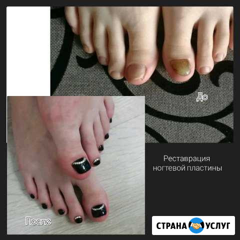 Педикюр аппаратный Зима - изображение 1
