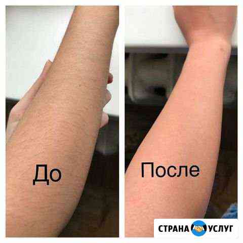 Шугаринг Челябинск