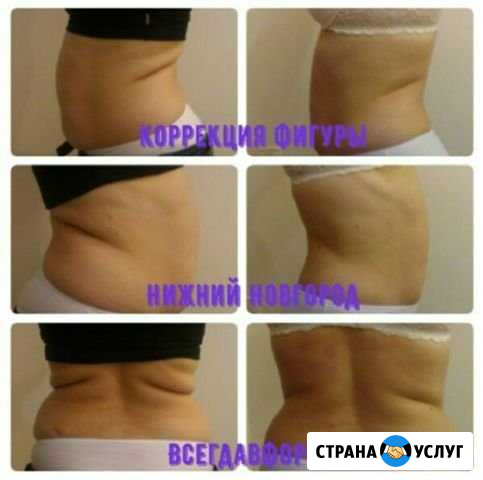 Коррекция фигуры Нижний Новгород - изображение 1