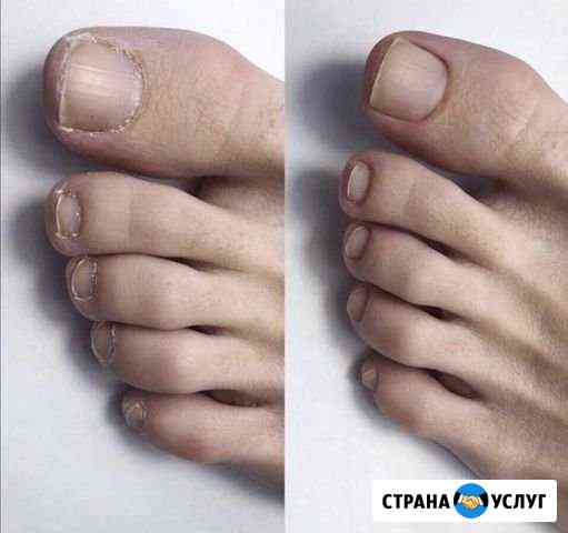 Педикюр Ставрополь