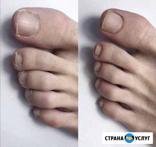 Педикюр Ставрополь - изображение 1