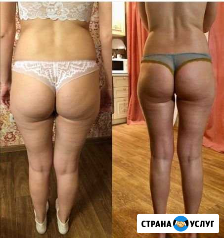 Массаж Кемерово - изображение 1