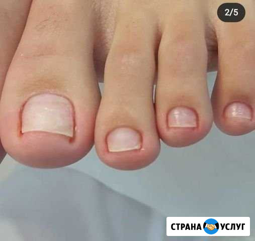 Педикюр Казань - изображение 1