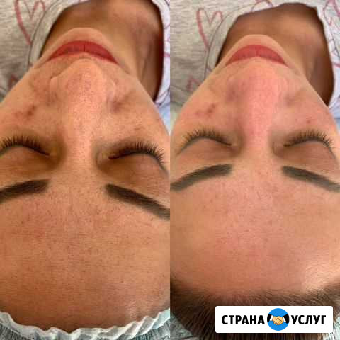Косметолог Самара - изображение 1