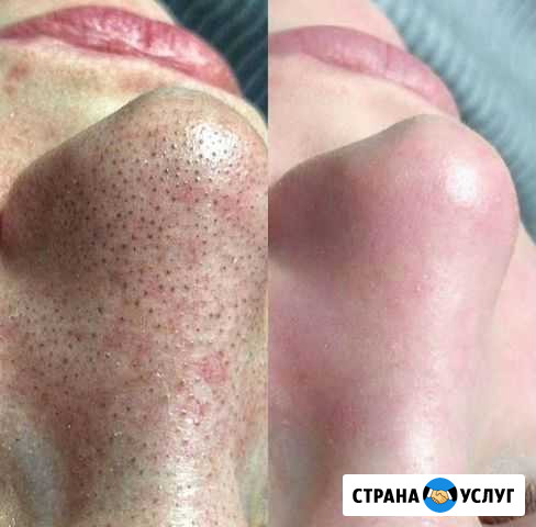 Косметология Санкт-Петербург - изображение 1
