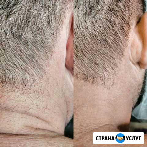 Мужской Шугаринг Депиляция Воск Сахар Сочи - изображение 1
