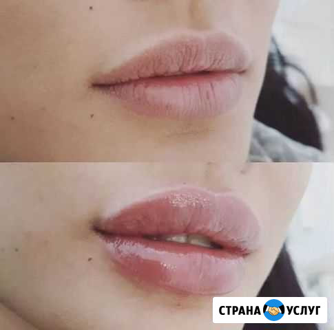 Косметолог Владикавказ - изображение 1
