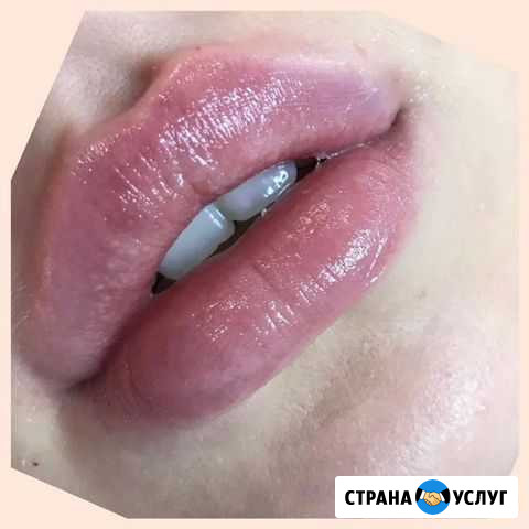 Косметолог Ярославль - изображение 1